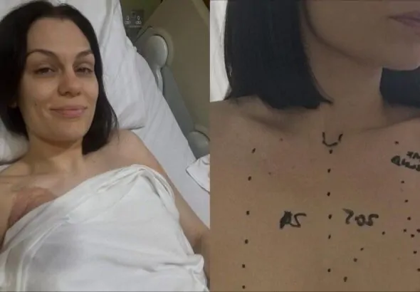 Jessie J's Brave Battle: Overcoming Breast Cancer Surgery