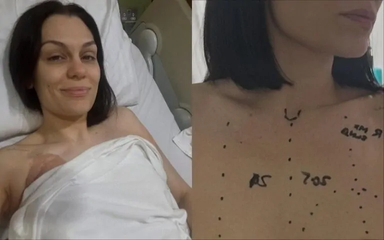 Jessie J's Brave Battle: Overcoming Breast Cancer Surgery